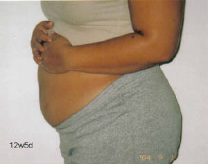 12w5d-belly.jpg