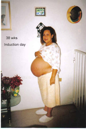 38wk-belly-induction-day.jpg