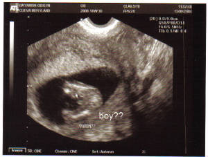 baby-14w3d-boy.jpg