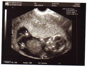 baby-14w3d.jpg