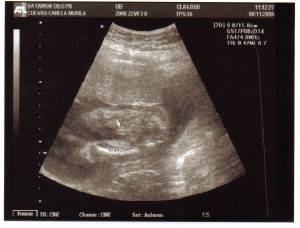 baby-22w3d-boy-2.jpg