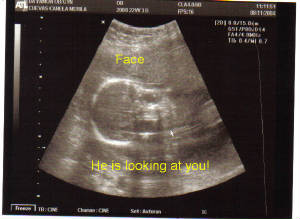 baby-22w3d-face.jpg
