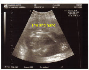 baby-22w3d-hand.jpg