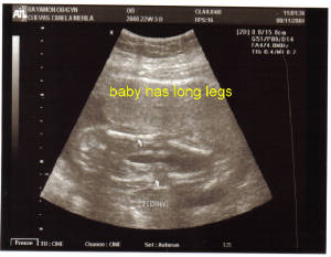 baby-22w3d-legs.jpg