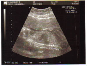 baby-22w3d-spine.jpg