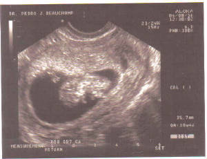 bean-10w3d.jpg