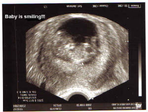 bean-11w3d-smile2.jpg