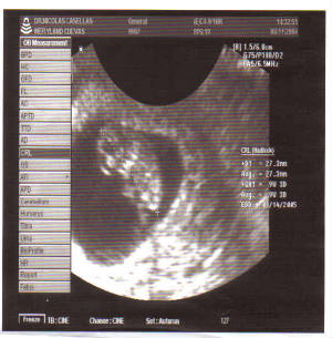 bean-9w5d.jpg
