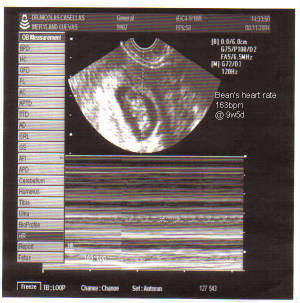 bean-hr-9w5d.jpg