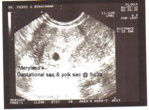 yolk-sac.jpg